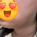 블링샵 | 대전광역시 서구 도안동 블링샵/비엘에스테틱 / 이중턱 없애기 / 슬리밍젯 후기
