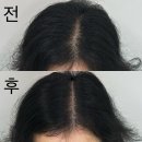 이디야커피인천부평U1센터 | 밀도보강SMP 50대 어머니 정수리커버 효도 smp 맛집 "Mooon smp"
