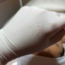 김포 마산동 에스테틱샵 예뻐지는 지금 여드름케어 7회차 후기