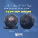 수원 남자 탈모,벗어나고 싶지 않으면 이 글을 읽지 마세요.