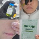 성안화장품 | 울산 중구 피부관리 위크원 바이오리필 후기