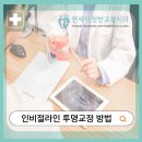 요요치과의원 | 인비절라인 투명교정 방법. 덧니와 옥니,13개월만의 변화 사례