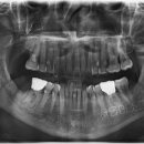 미소린치과의원 이미지