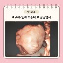 참여성병원 이미지