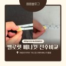 온더핏센텀시티점 | 벨로핏 베나컷 후기 전후비교 ! 뱃살 제거와 체지방 관리 다이어트