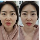하니루비셀뷰티랩