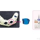 나비덴탈 이미지