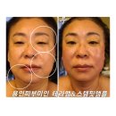 로이코스메틱 이미지