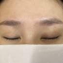 마젤헤어라인