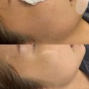 썸 | 순천 스킨플래닝 잘하는 곳, 신대 지구 &#39;썸뷰티&#39; 솔직후기