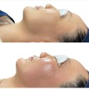 레티나메디칼 이미지