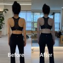 11650-17-196-28 | 장유 율하 슈로스 운동과 필라테스를 통한 성인 척추 측만 체형 교정 후기