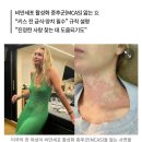 키스하면 죽는 여자 이미지