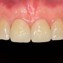 이라인치과기공소 이미지