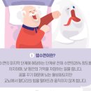 잠꼬대 원인, 렘수면 장애 (렘수면 뜻) 이미지