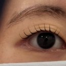 리아나 서울 | 자연스럽게 또렷한 눈매 완성! 리아나서울 방문 후기
