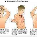 근막통증증후군 : 어깨통증 이미지