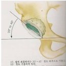 ＜제 8강 내용정리＞ THR OP 후 재활운동 프로토콜 이미지