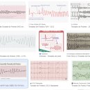 PULSE Training | [KALS Provider] 공부하기 / 간호사 CPR 자격증