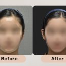 압구정연세안과의원 이미지