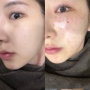 서울아이정신과의원 - 노원구 노해로 492 | 종로 피부과 ’오블리브의원 서울오리진‘ 쥬베룩스킨+아이리쥬란 내돈내산 후기