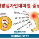 전방십자인대파열과일상생활 복귀 이미지