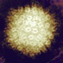 ﻿수두-대상포진바이러스 이미지