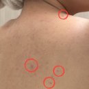 하베레피부전문센터