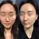 천지빛깔 | 사당수분관리 천지빛깔에스테틱 사당재생관리 후기