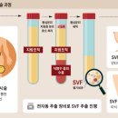 이큅포스킨 이미지