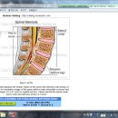 디스크파열,즉 추간판탈출증에 대한 정보 이미지