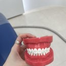 미라클덴탈 | 대구 무삭제 라미네이트 상담받고 온 후기