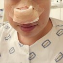 [여의도성모병원]비염 코골이 비중격만곡증 하비갑개 수술 후기 3편