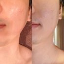 새얀뷰티 | 서면피부관리 고주파 윤곽관리 새얀에스테틱