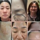 #인셀덤화장품 꾸준한 사용후기 8년째 직접 사용하며 느낀 변화