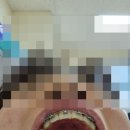 닥터오치과의원 | 창원 사랑니 발치 잘 빼는 치과 닥터오 후기