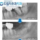 덴탈스페이스 이미지