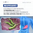 전 세계적으로 가장 많은 암 발병을 일으키는 병원체인 H. pylori(헬리코 박터)에 대해 알아야 할 사항 이미지