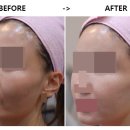 비스포크의원 이미지