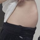 한아름요양병원 | 임신일기] 예비말띠맘 조기진통 병가 눕눕 처방, 임신 중기 정밀초음파, 눕눕하고 요양하는 힐링 한 주