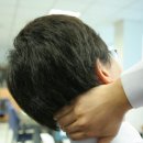 뇌졸중 이미지