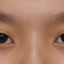 올리팅성형외과의원 이미지