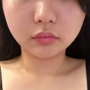 이마트24 달서호산점 | 대구 달서구 월성동 에스테틱 온핏 테라피 이중턱관리 하울뷰티