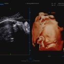 우리맘산부인과의원 이미지