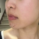 차좀볼줄압니더 | [동탄] 내돈내산 아그네스 3-4회차 후기/ 통증 및 부작용, 원장님 추천