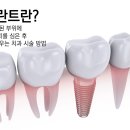 본기공소 이미지