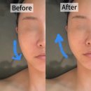 주안세탁 | [주안피부관리] 예하에스테틱에서 신부관리 받은 후기! 재방문의사 100%👰🏻‍♀️🤍