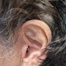 독일보청기 광주난청센터 | <구미보청기> 85세 중도 난청 고객분 시그니아 독일보청기 충전식 오픈형 타입 편측 착용 사례