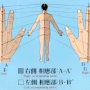 뜸 이미지