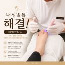판타지네일 | 화성 병점 내성발톱 관리 후기, 네일판타지